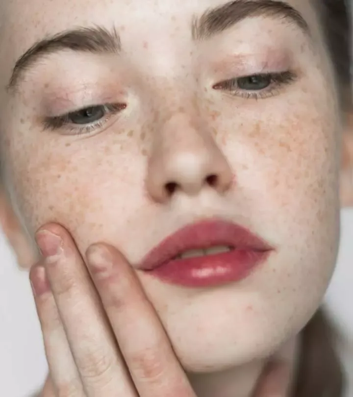 How Do Sun & Age Spots Develop?